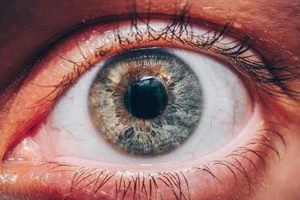 edema macular imgpri 1