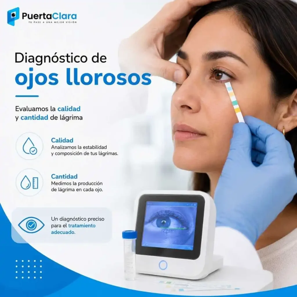 diagnostico ojo lloroso pc