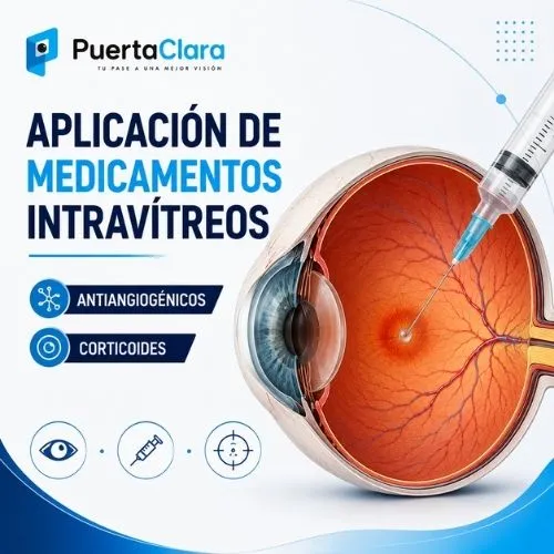 inyeccion intavitrea edema macular pcblog
