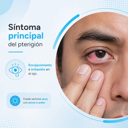 sintoma pterigión pc