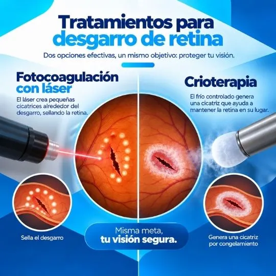 tratamiento desgarro de retina pc 2 